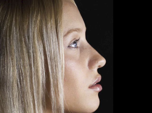 Armonización Facial desde cero
